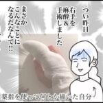 指を手術しました(突然)