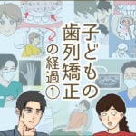 子どもの歯列矯正の経過①